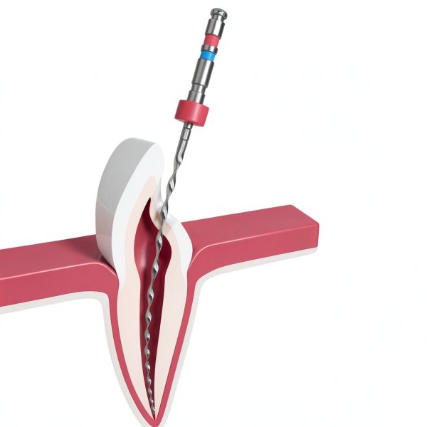 Easyinsmile Endo H File Stainless Dental Set #6-#80 Colored Handles-3